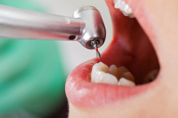 Best Weekend Emergency Dentist in Columbus, WI